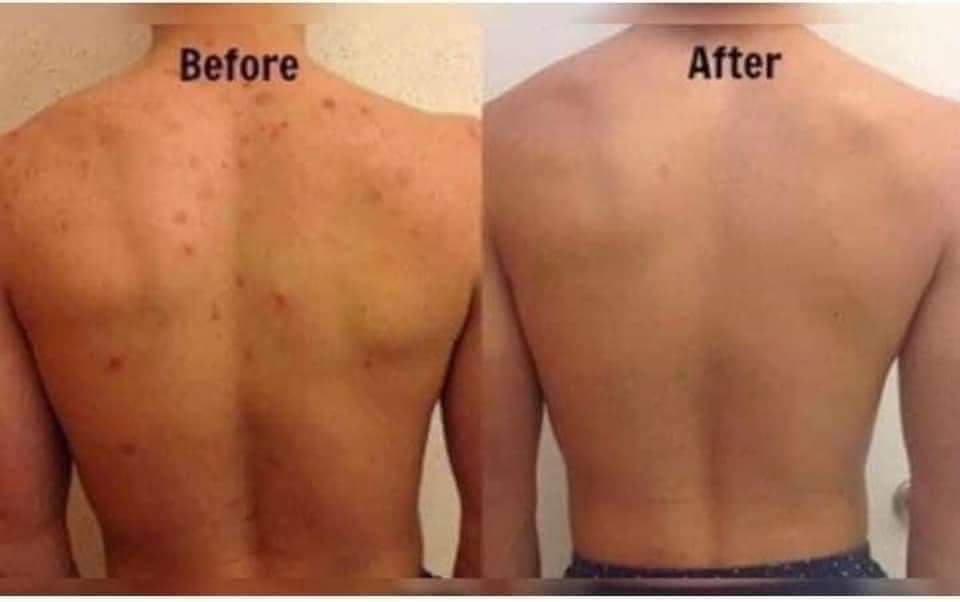 Nu Skin Epoch Polishing Bar